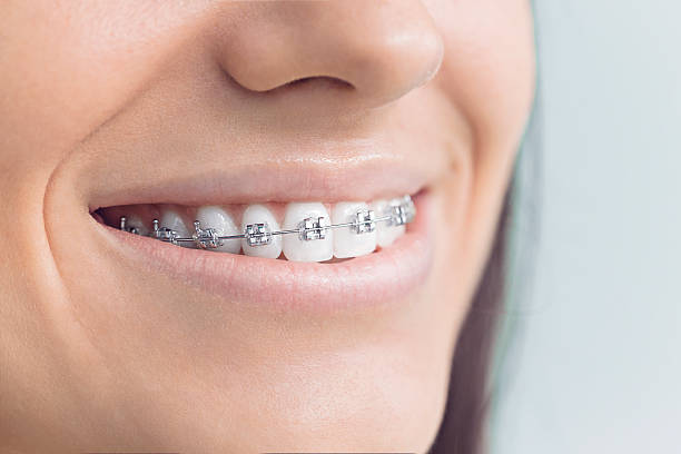 Best Dental Fillings (Composite and Amalgam)  in Saranap, CA